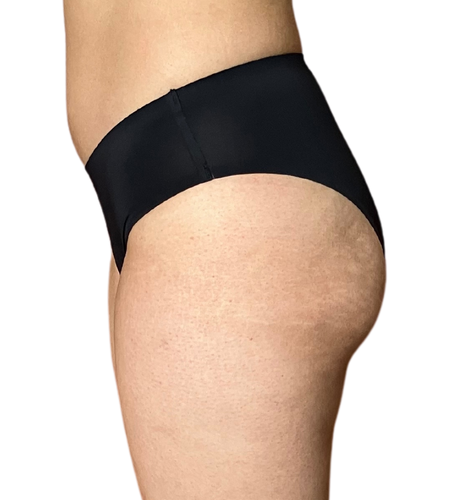 Traje de Baño Atlas - (sin costuras)