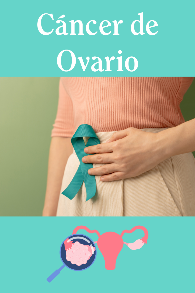 Prevenir el Cáncer de Ovario: Consejos Esenciales para tu Salud Femenina