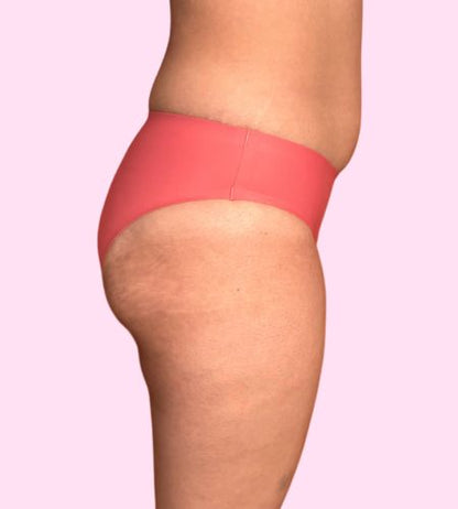 Traje de Baño Atlas - (sin costuras) - Ligero a Moderado