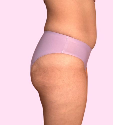 Traje de Baño Atlas - (sin costuras) - Ligero a Moderado