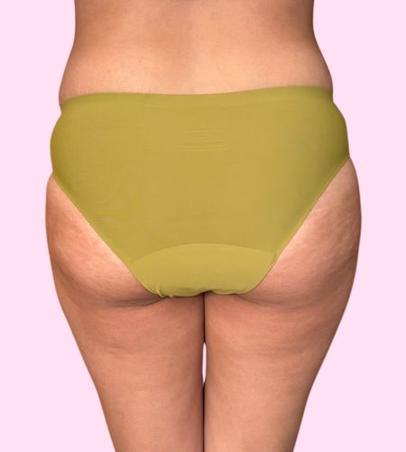 Traje de Baño Atlas - (sin costuras) - Ligero a Moderado