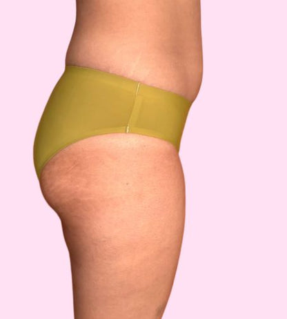 Traje de Baño Atlas - (sin costuras) - Ligero a Moderado