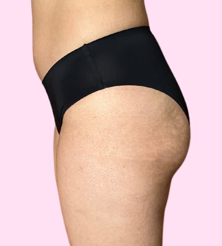 Traje de Baño Atlas - (sin costuras) - Ligero a Moderado