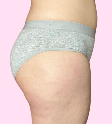 Rhea - Moderado Niñas